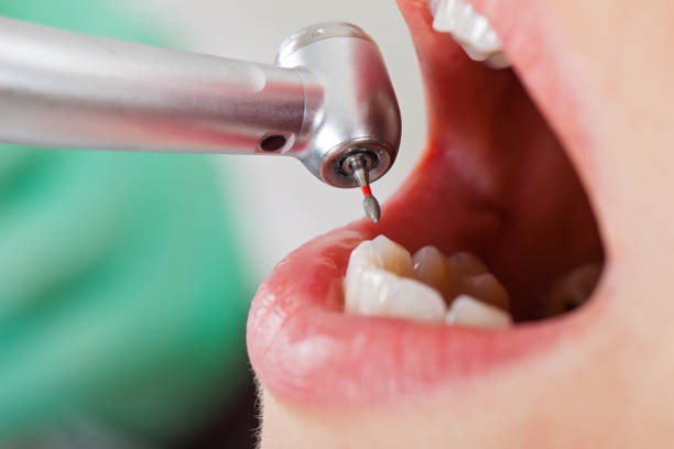 Best Emergency Treatment for Oral Infections in Americus, GA